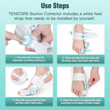 FLEXIBLE BUNION CORRECTOR